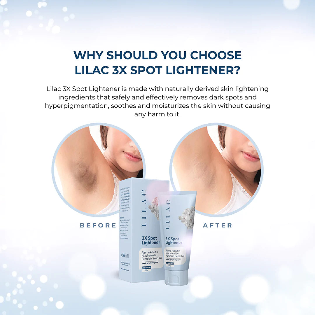 Lilac 3X Spot Lightener (50g)