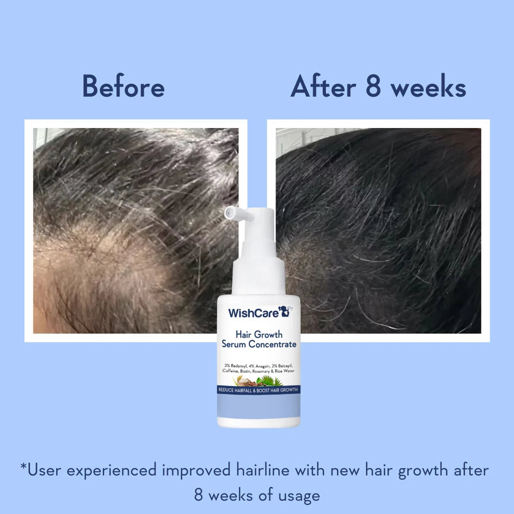 WishCare Hair Growth Serum Concentrate (30ml)