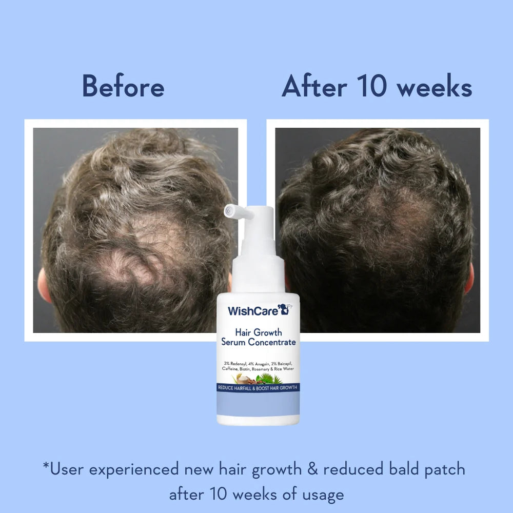 WishCare Hair Growth Serum Concentrate (30ml)