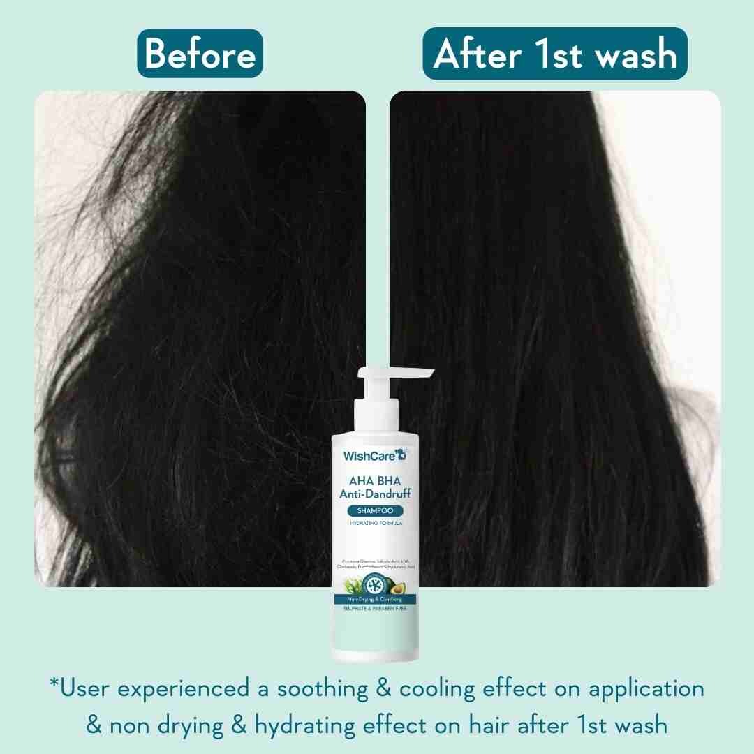 WishCare AHA BHA Anti-Dandruff Shampoo (250ml)