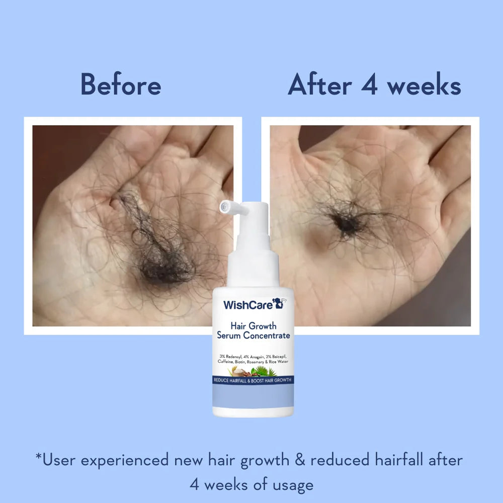 WishCare Hair Growth Serum Concentrate (30ml)