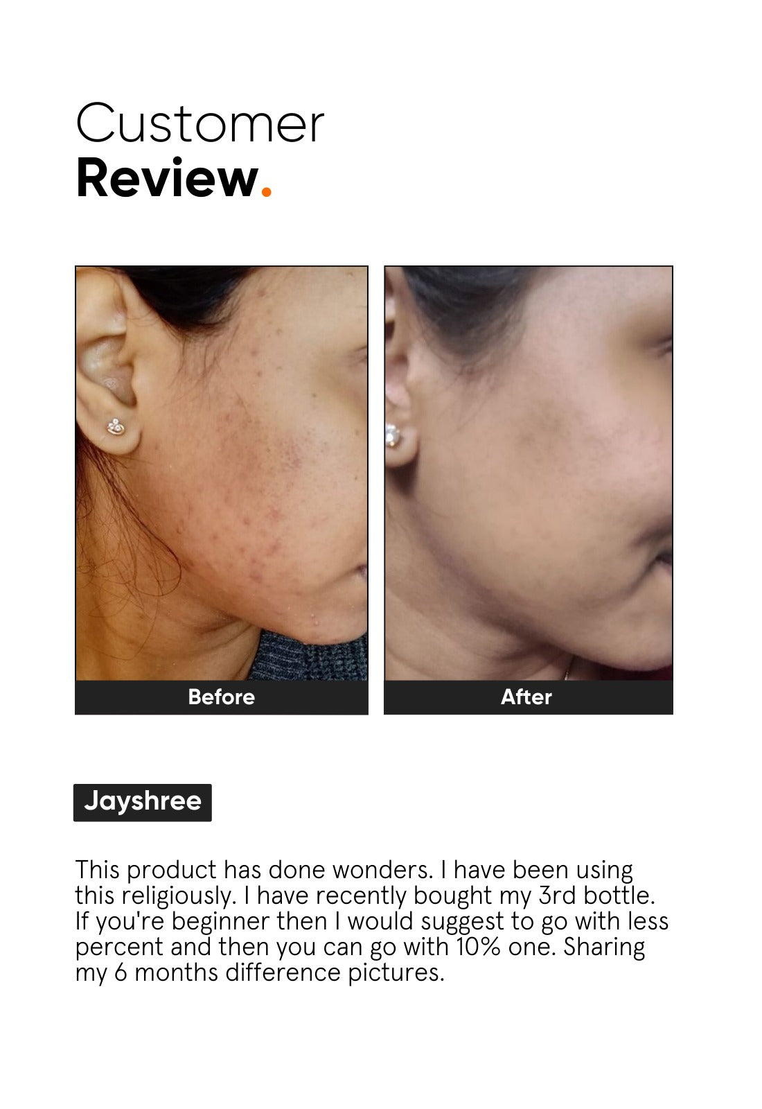 Minimalist Niacinamide 10% Face Serum (30ml)
