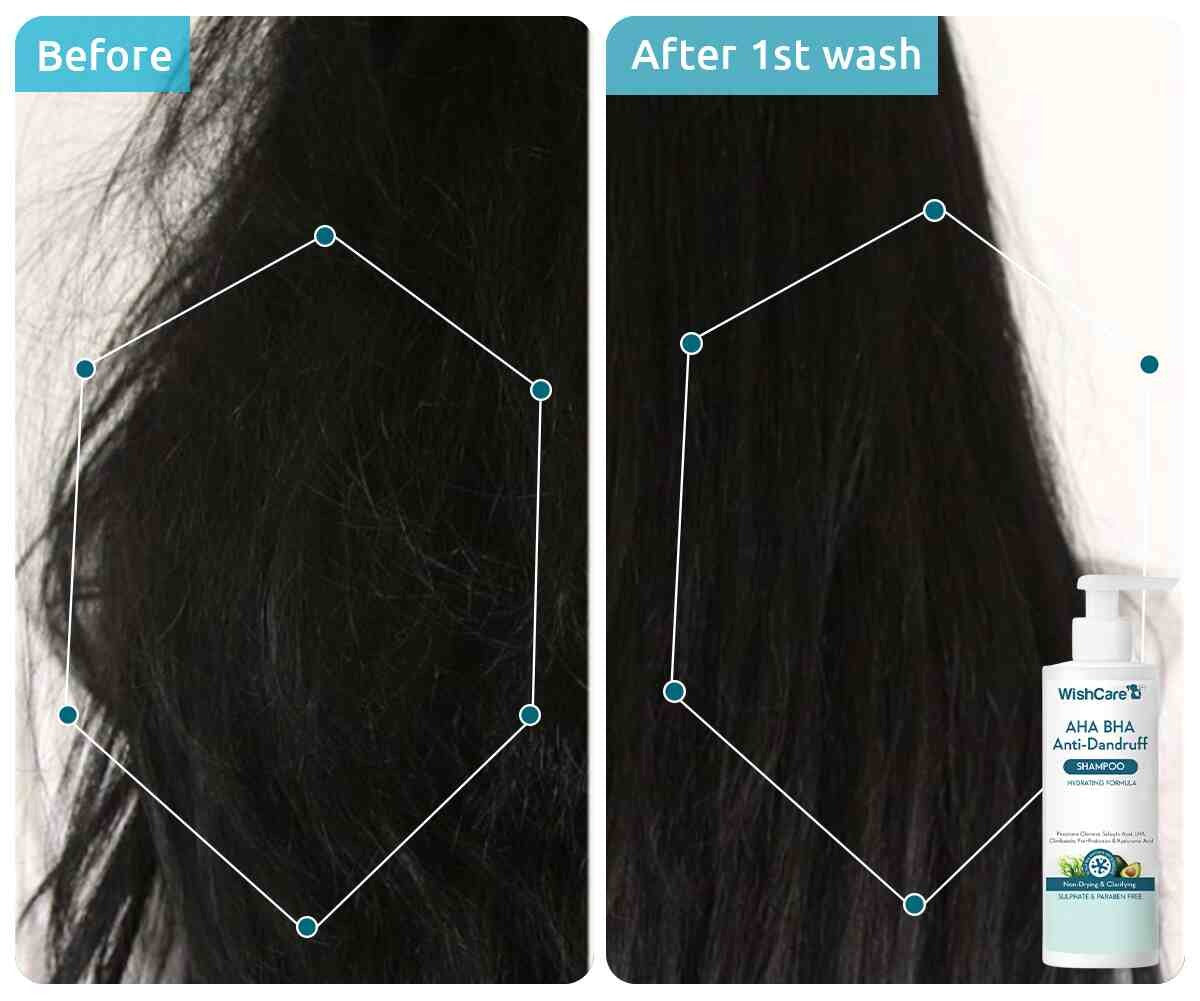 WishCare AHA BHA Anti-Dandruff Shampoo (250ml)
