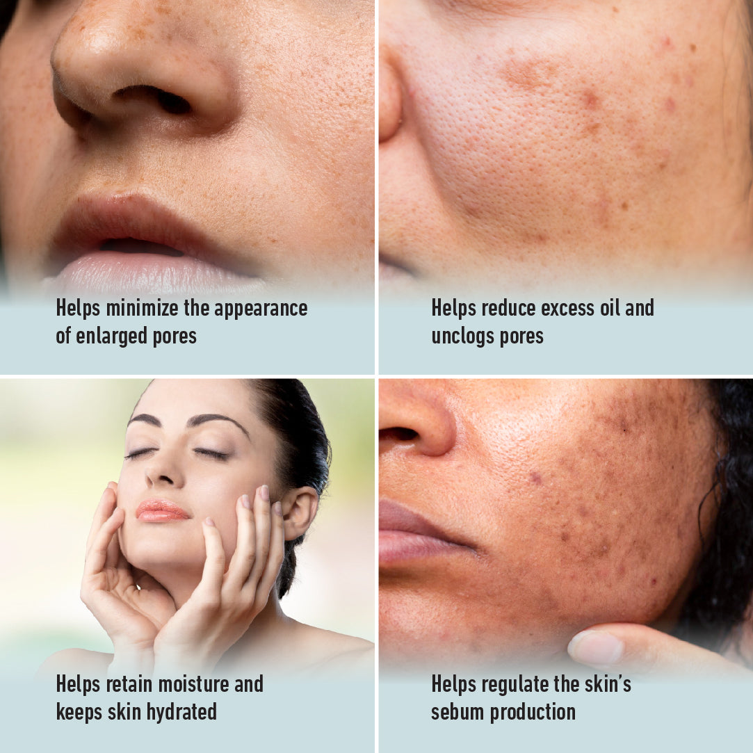 Skin Cafe My Therapist Serum – Pore Perfect (30ml)