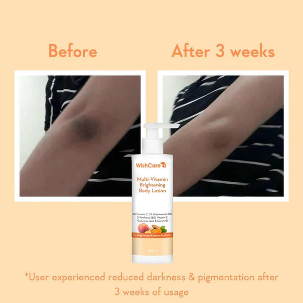 Wish Care Multi Vitamin Brightening Body Lotion (200ml)