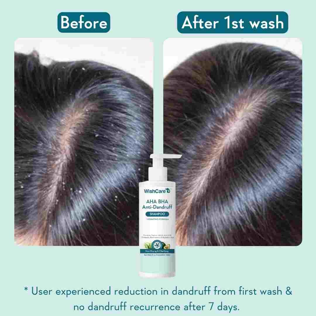 WishCare AHA BHA Anti-Dandruff Shampoo (250ml)