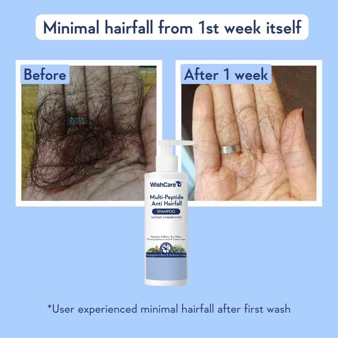 WishCare Multi-Peptide Anti Hairfall Shampoo (250ml)