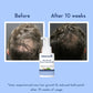 WishCare Hair Growth Serum Concentrate (30ml)
