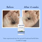 WishCare Hair Growth Serum Concentrate (30ml)