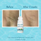 WishCare Under Arm Roll On Serum (50ml)