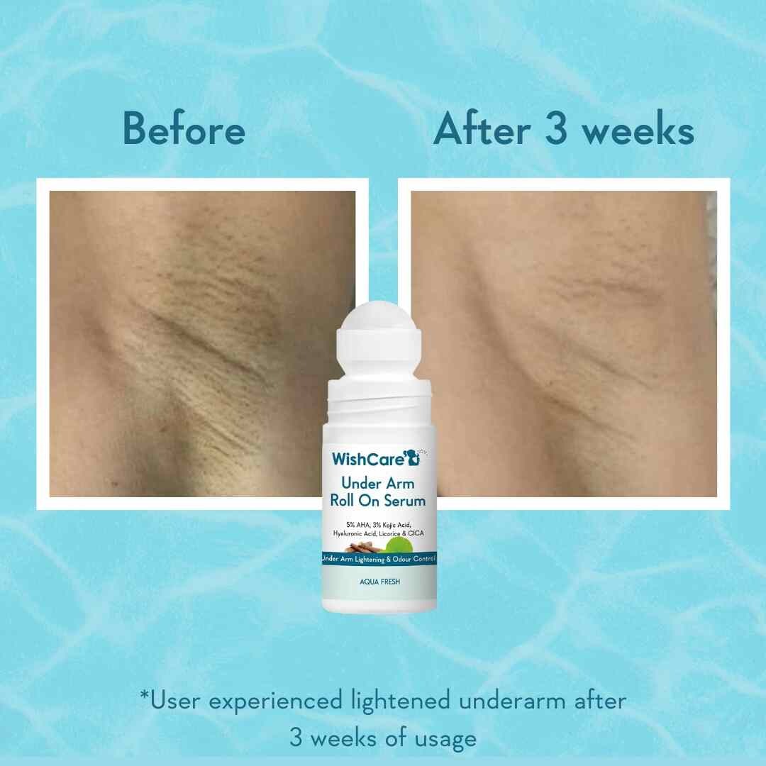 WishCare Under Arm Roll On Serum (50ml)