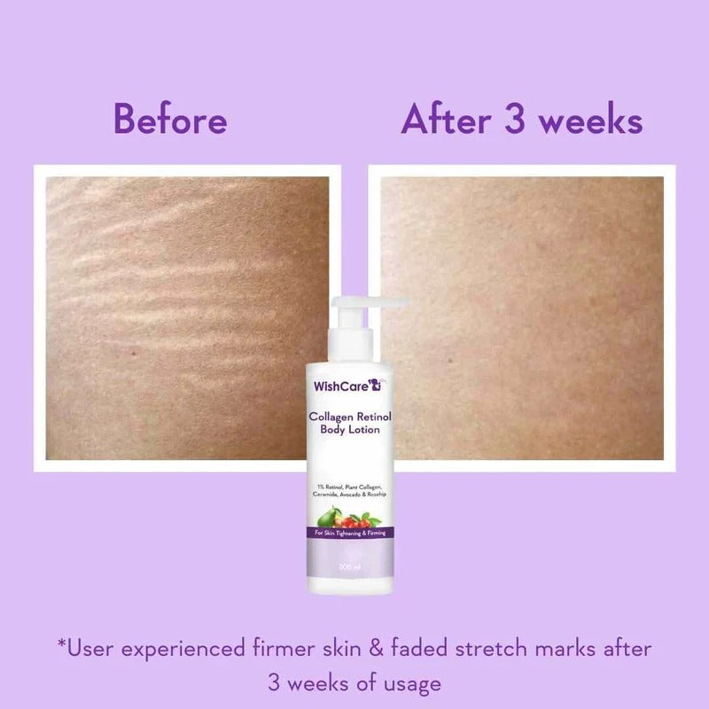 WishCare Collagen Retinol Body Lotion (200ml)