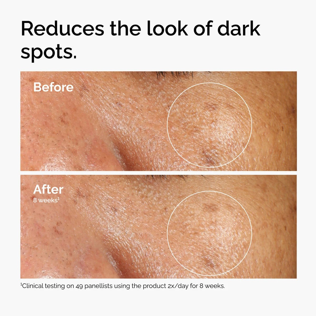 The Ordinary Alpha Arbutin 2% + HA (30ml)